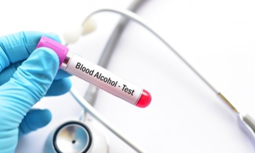 Testing for Drugs and Alcohol in the Workplace &ndash; What Employers Should Know